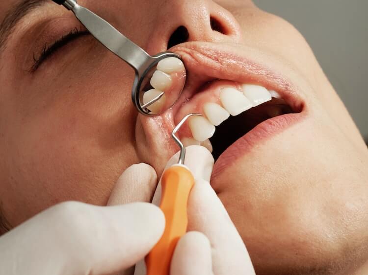 How To Become A Dental Hygienist 